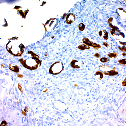 Cytokeratin 7; Clone OV-TL12/30 (Ready-To-Use)